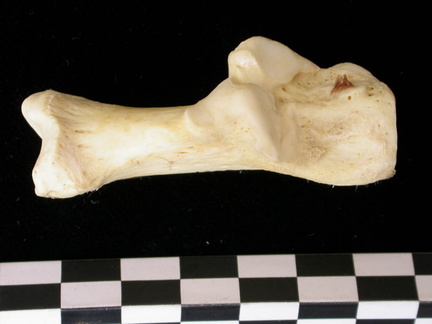 Calcanéus