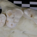 Dentition supérieure