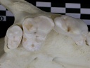 Dentition supérieure