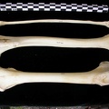 Fémur, tibia et fibula