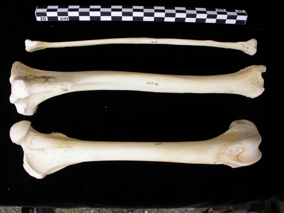 Fémur, tibia et fibula