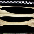 Fémur, tibia et fibula (12054 visites) Canis lupus - Adulte - Éléments droitsCollection : Centre d'Investigation Portugais d'Archéologie... Fémur, tibia et fibula
