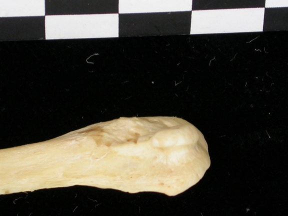 Fibula : partie distale