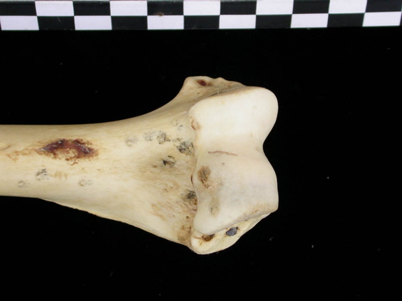 Humérus : partie distale