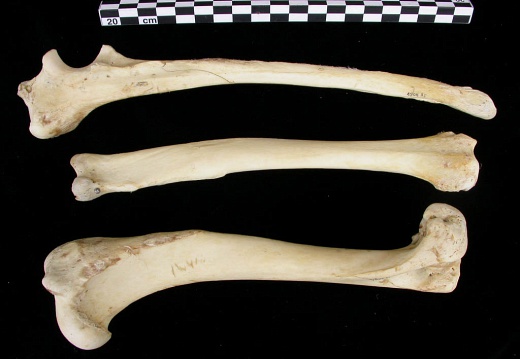 Humerus,radius and ulna