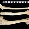 Humérus, radius et ulna