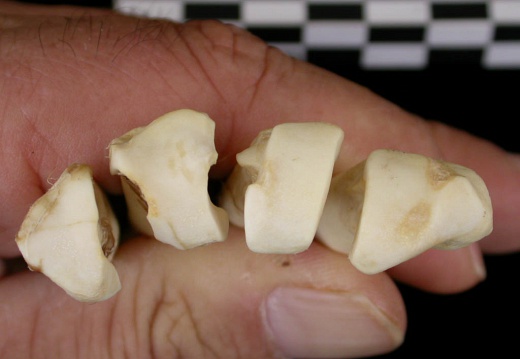 Metacarpals: proximale part