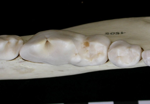 Lower teeth