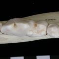 Dentition inférieure
