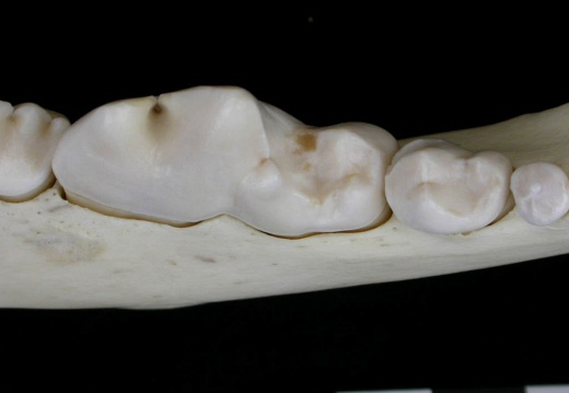 Lower teeth