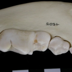 Dentition inférieure