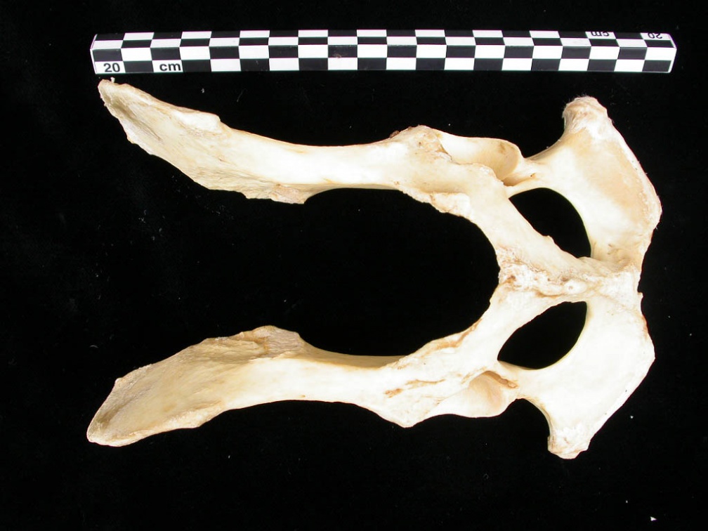 Pelvis