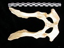 Pelvis