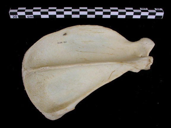 Scapula : vue latérale