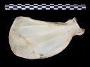Scapula : vue médiale