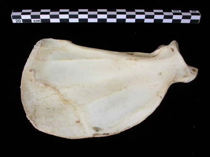 Scapula : vue médiale