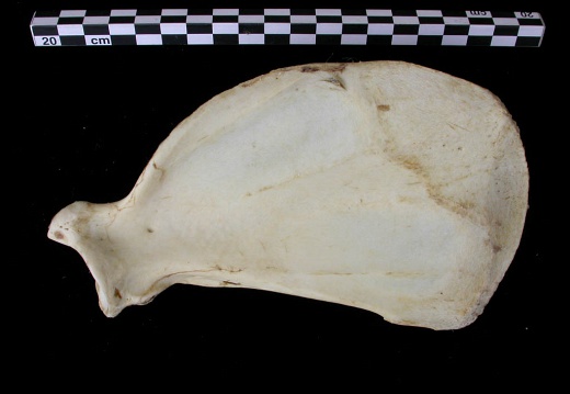 Scapula: medial view