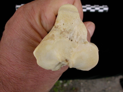 Tibia: parte proximal