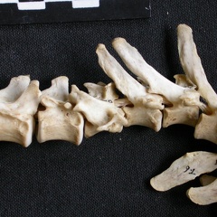 Vertebrae