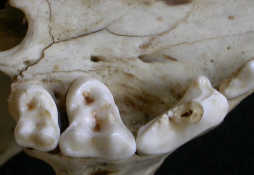 Dentition supérieure