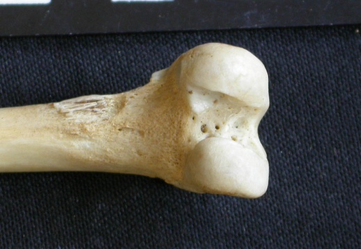 Femur: distal part