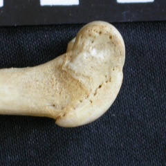 Femur: distal part