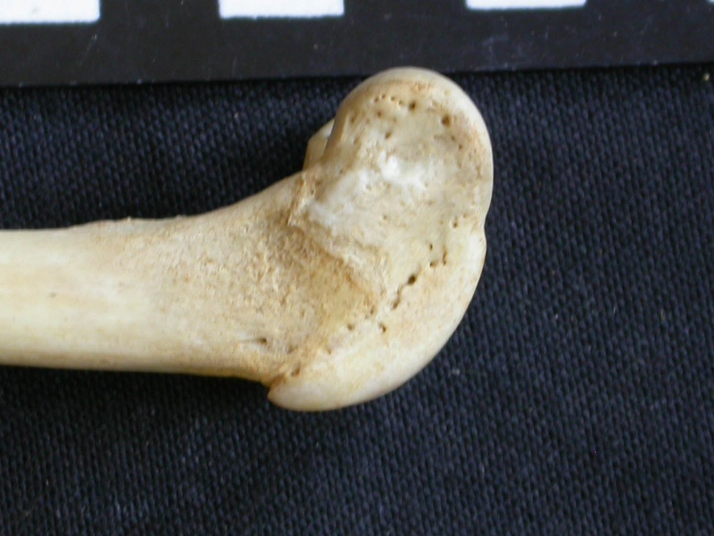 Femur: distal part