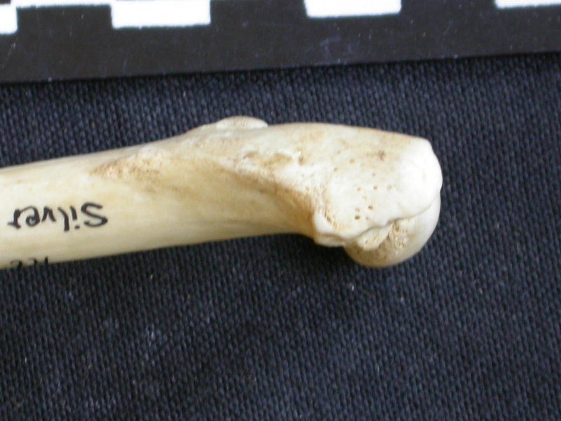 Femur: proximale part