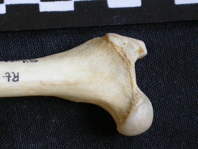 Femur: proximale part