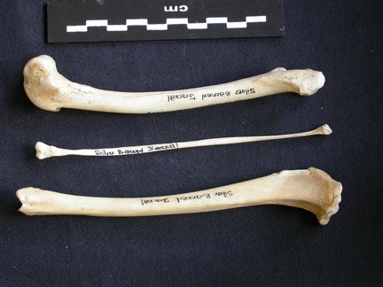  Femur, tibia and fibula