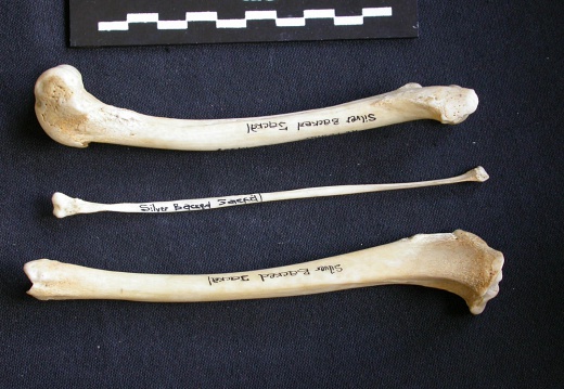  Femur, tibia and fibula