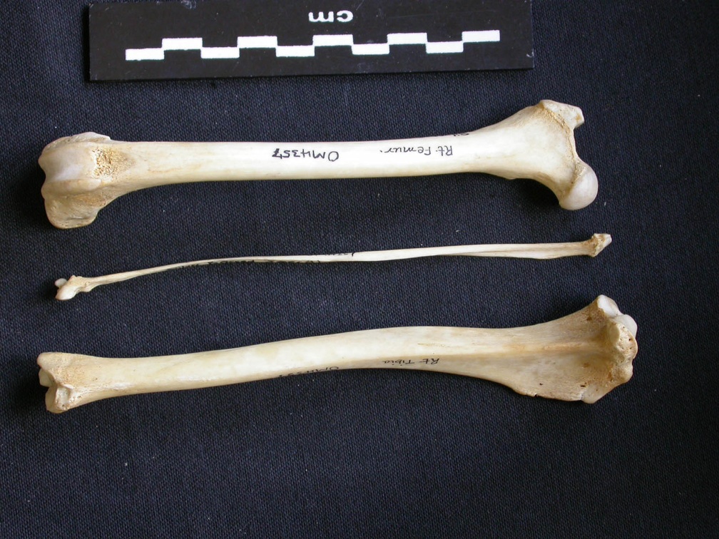  Femur, tibia and fibula