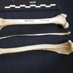 Fémur, tibia et fibula (11215 visites) Canis mesomelas - Mâle - Adulte - Éléments droitsKenya, Nairobi (Id:OM4357) - Pays : Embakasi Roa... Fémur, tibia et fibula