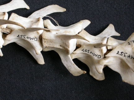 Lumbar vertebrae