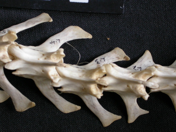 Vertèbres lombaires