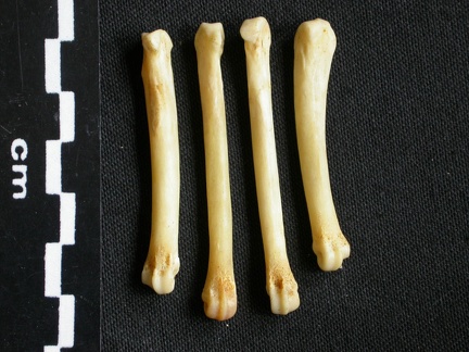 Metacarpals