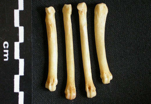 Metacarpals