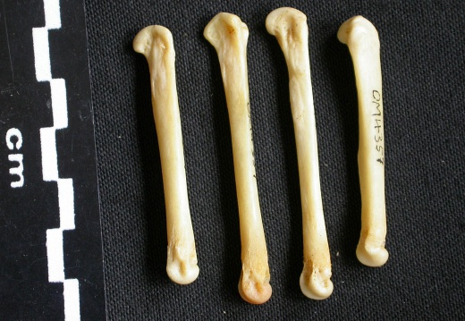 Metacarpals