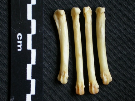 Metacarpals