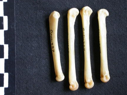 Metacarpals