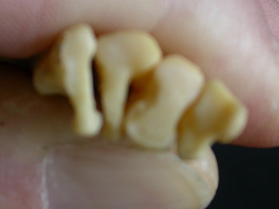 Metatarsals: proximale part (7465 visits) Canis mesomelas - Male - Adult - Right elementsCollection: Department d'Osteology of National Museu... Metatarsals: proximale part