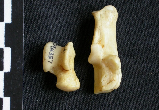 Talus and calcaneus