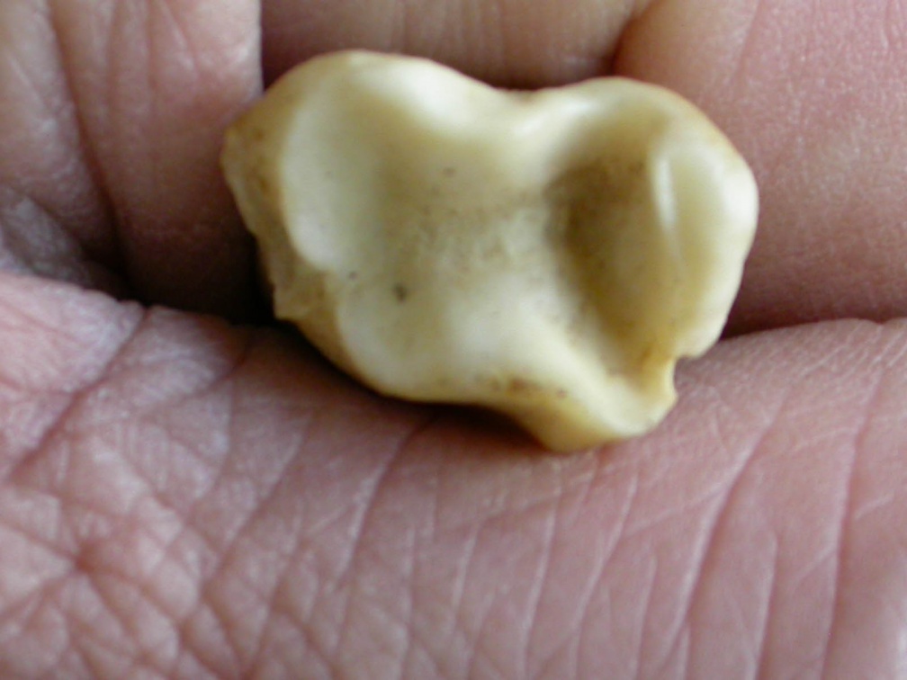 Tibia : partie distale