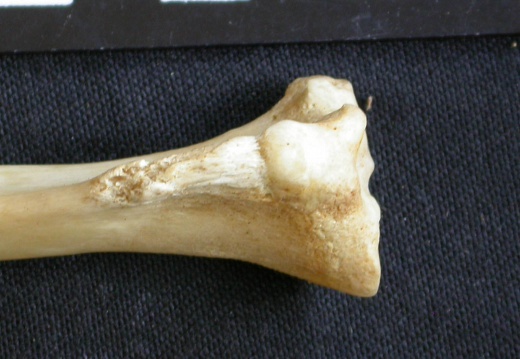  Tibia: proximale part