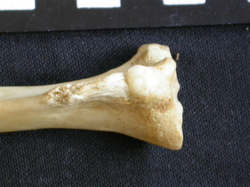  Tibia: proximale part