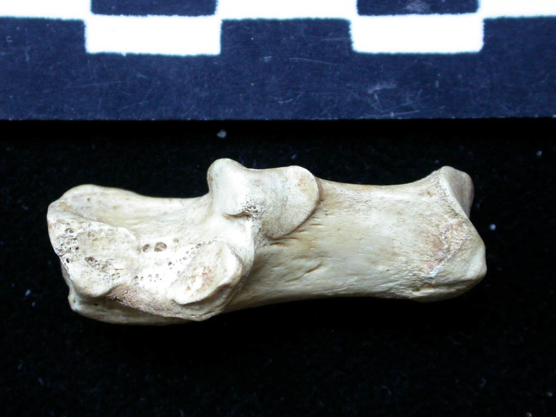 Calcaneus