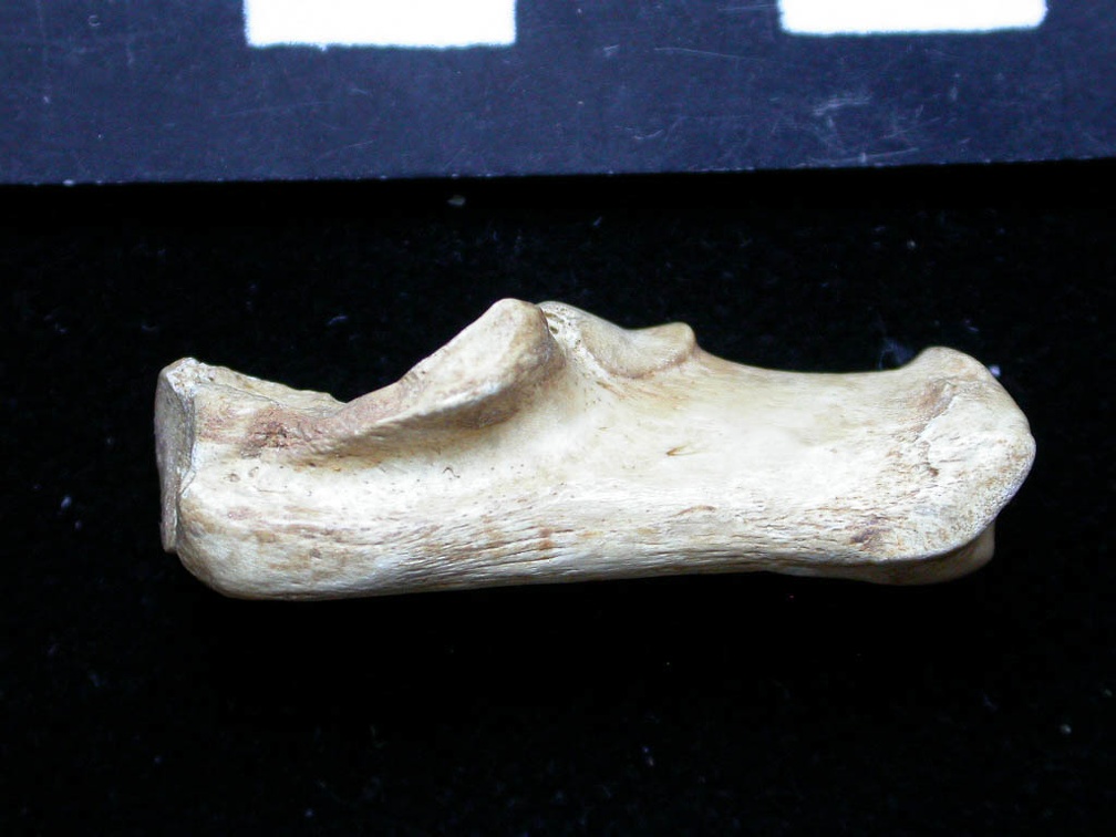 Calcaneus