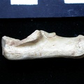 Calcaneus