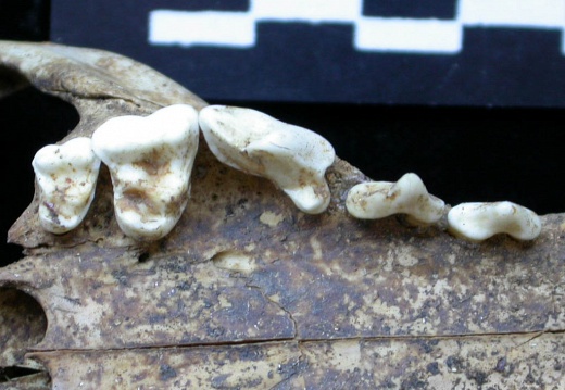 Dentition supérieure