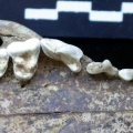 Dentition supérieure